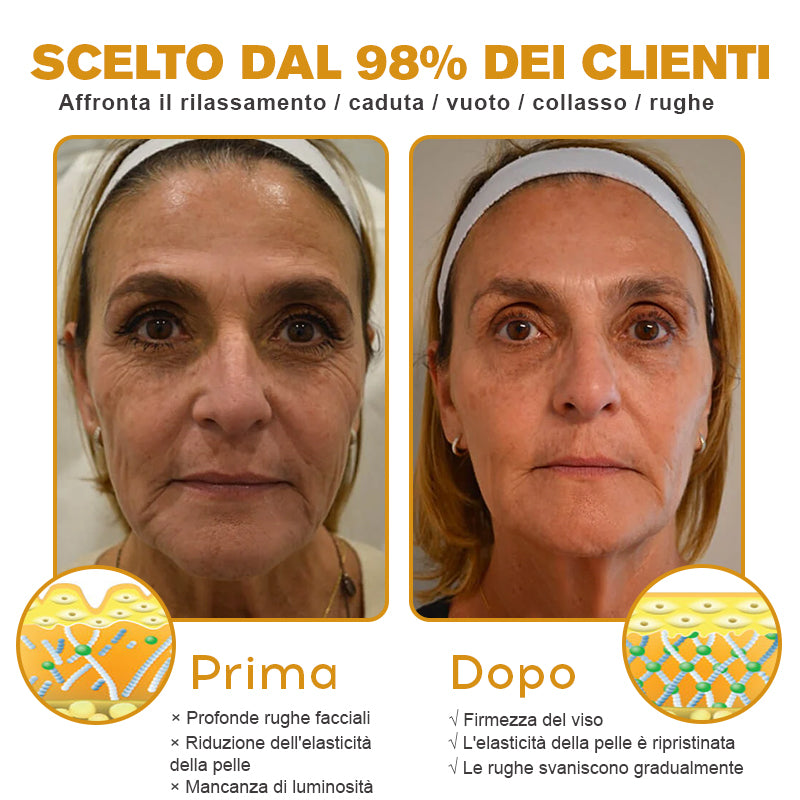 💎🍀 Prodotto e spedito dall'Italia✨ Furzero™ Botox Crema Rimuovi Rughe al Veleno d'Ape - 🔥 ULTIMO GIORNO SCONTO DEL 70%