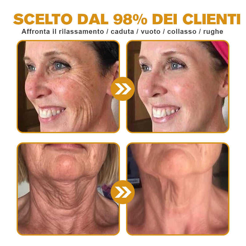 🐝🌿 Prodotto e spedito dall'Italia✨ Furzero™ Botox Crema Rimuovi Rughe al Veleno d'Ape - 🔥 ULTIMO GIORNO SCONTO DEL 70%