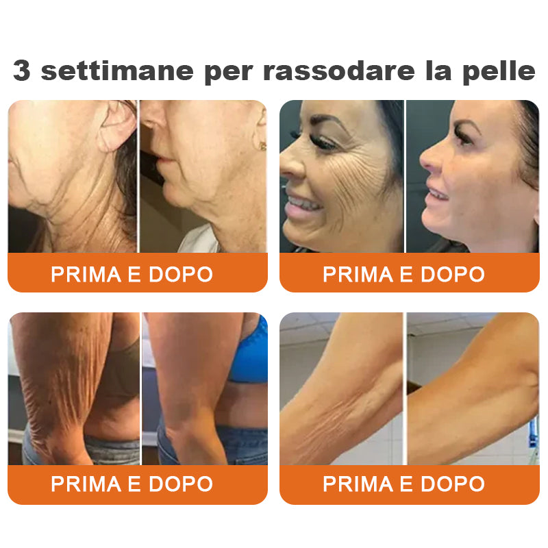 ✨Prodotto e spedito dall'Italia✨Siero rassodante in stick al veleno d'ape Flysmus™ Stick Siero Rassodante al Veleno d'Api Botox