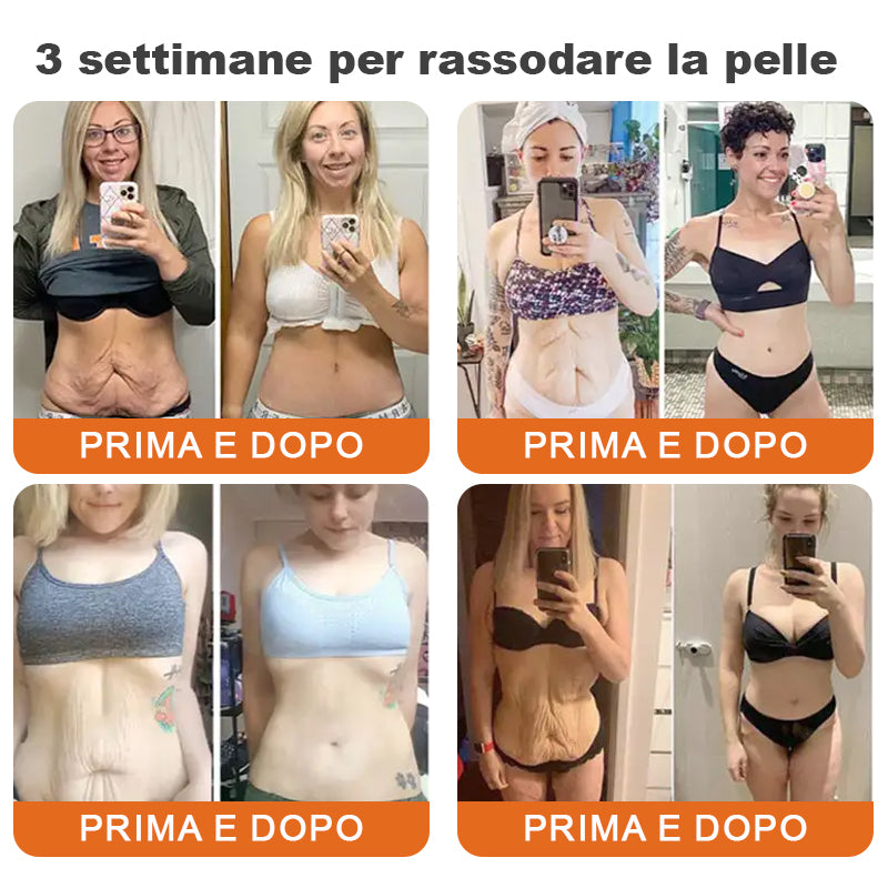 ✨Prodotto e spedito dall'Italia✨Siero rassodante in stick al veleno d'ape Flysmus™ Stick Siero Rassodante al Veleno d'Api Botox