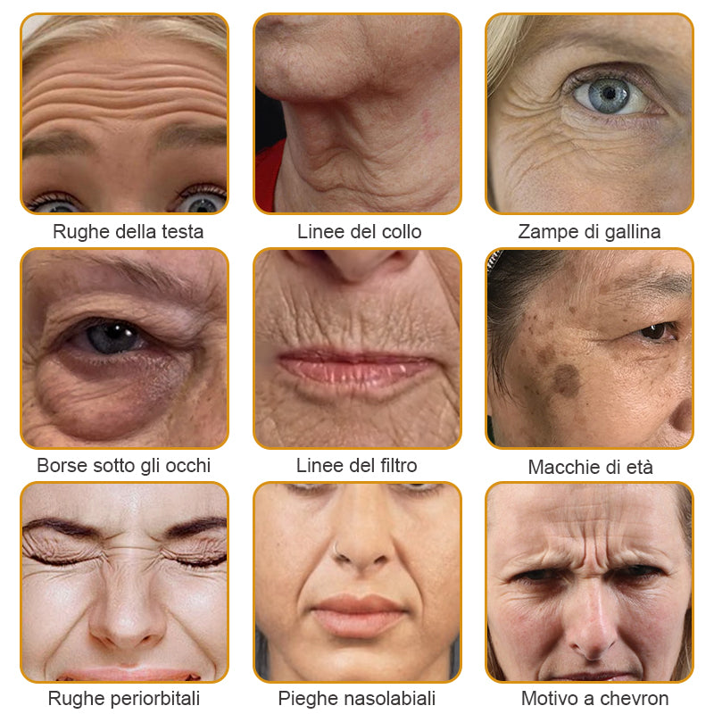 🐝🌿 Prodotto e spedito dall'Italia✨ Furzero™ Botox Crema Rimuovi Rughe al Veleno d'Ape - 🔥 ULTIMO GIORNO SCONTO DEL 70%