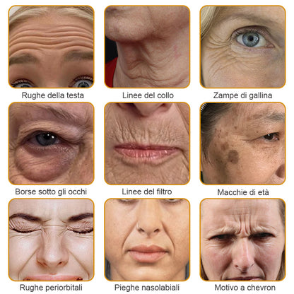 🐝🌿 Prodotto e spedito dall'Italia✨ Furzero™ Botox Crema Rimuovi Rughe al Veleno d'Ape - 🔥 ULTIMO GIORNO SCONTO DEL 70%