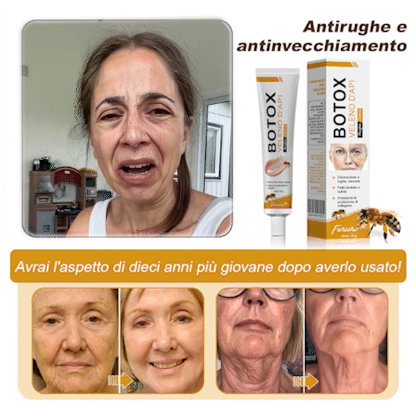 🐝🌿 Prodotto e spedito dall'Italia✨ Furzero™ Botox Crema Rimuovi Rughe al Veleno d'Ape - 🔥 ULTIMO GIORNO SCONTO DEL 70%